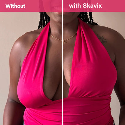 The Nipple Cover that lifts