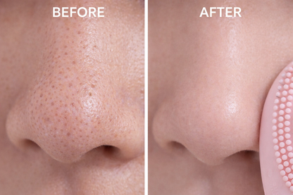 Facial Cleansing Brush